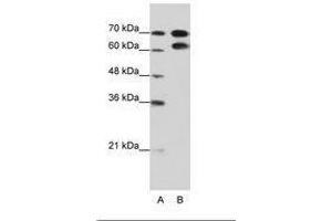 Image no. 2 for anti-Ribonucleoprotein, PTB-Binding 1 (RAVER1) (AA 24-73) antibody (ABIN202804) (RAVER1 抗体  (AA 24-73))
