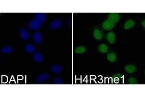 Immunofluorescence analysis of 293T cell using H4R3me1 antibody. (Histone 3 抗体  (meArg3))