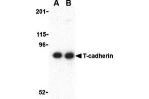 Western Blotting (WB) image for anti-Cadherin 13 (CDH13) (N-Term) antibody (ABIN1031598) (Cadherin 13 抗体  (N-Term))