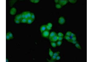 Immunofluorescent analysis of PC-3 cells using ABIN7153900 at dilution of 1:100 and Alexa Fluor 488-congugated AffiniPure Goat Anti-Rabbit IgG(H+L) (GNPDA2 抗体  (AA 28-154))