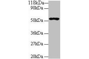 Western blot All lanes: GLP1R antibody at 2 μg/mL + 293T whole cell lysate Secondary Goat polyclonal to rabbit IgG at 1/10000 dilution Predicted band size: 54 kDa Observed band size: 54 kDa (GLP1R 抗体  (AA 24-145))