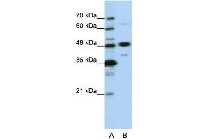 WB Suggested Anti-NOL4 Antibody Titration:  0. (NOL4 抗体  (N-Term))