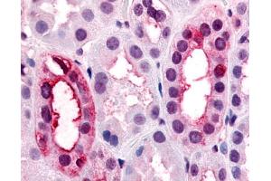 Anti-VN1R1 antibody IHC of human kidney, renal tubules. (VN1R1 抗体  (Extracellular Domain))