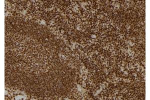 ABIN6259043 and ABIN6274716 at 1/100 staining Mouse spleen tissue by IHC-P.