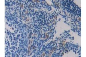 Detection of RIPK3 in Mouse Ovary Tissue using Polyclonal Antibody to Receptor Interacting Serine Threonine Kinase 3 (RIPK3) (RIPK3 抗体  (AA 16-239))