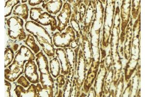 ABIN6278080 at 1/100 staining Mouse kidney tissue by IHC-P. (HIPK2 抗体  (N-Term))