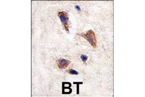 Formalin-fixed and paraffin-embedded human brain tissue reacted with CKK2 antibody (C-term)  , which was peroxidase-conjugated to the secondary antibody, followed by DAB staining. (CAMKK2 抗体  (C-Term))