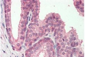 Human, Prostate: Formalin-Fixed Paraffin-Embedded (FFPE) (MZF1 抗体  (N-Term))