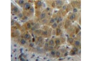 Used in DAB staining on fromalin fixed paraffin-embedded Liver tissue (Retinol Binding Protein 5 抗体  (AA 19-201))