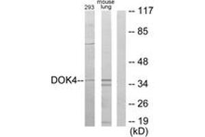 Western blot analysis of extracts from 293/mouse lung cells, using DOK4 Antibody. (DOK4 抗体  (AA 11-60))