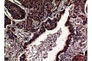 Immunohistochemistry (IHC) analysis of paraffin-embedded Human Lung, antibody was diluted at 1:100. (CD63 抗体  (Internal Region))
