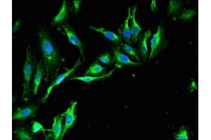 Immunofluorescent analysis of Hela cells using ABIN7151274 at dilution of 1:100 and Alexa Fluor 488-congugated AffiniPure Goat Anti-Rabbit IgG(H+L) (TRIM39 抗体  (AA 310-416))
