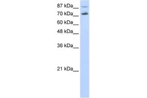 Western Blotting (WB) image for anti-Cell Division Cycle 25 Homolog B (S. Pombe) (CDC25B) antibody (ABIN2462389) (CDC25B 抗体)