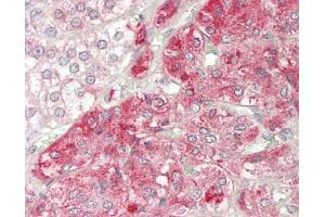 Immunohistochemistry (Paraffin-embedded Sections) (IHC (p)) image for anti-Melanocortin 2 Receptor Accessory Protein (MRAP) (AA 7-36) antibody (ABIN2588683)