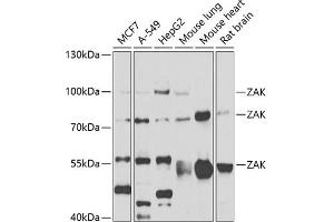 ZAK 抗体  (AA 1-330)