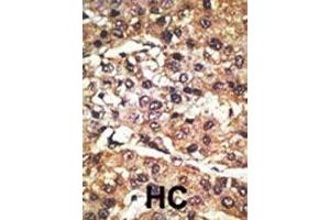 Immunohistochemistry (Paraffin-embedded Sections) (IHC (p)) image for anti-G Protein-Coupled Receptor 37 (Endothelin Receptor Type B-Like) (GPR37) (AA 97-126), (N-Term) antibody (ABIN390379)