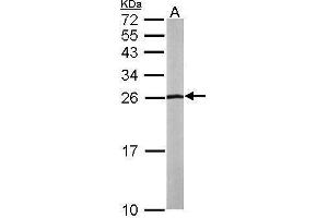 WB Image Sample (50 ug of whole cell lysate) A: mouse liver 15% SDS PAGE antibody diluted at 1:1000 (SLC9A3R2 抗体  (Center))