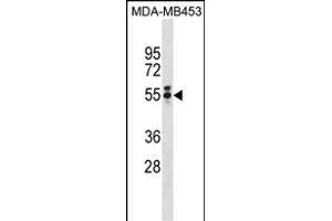T Antibody (N-term) (ABIN1881864 and ABIN2839039) western blot analysis in MDA-M cell line lysates (35 μg/lane). (T Antigen (AA 15-43), (N-Term) 抗体)