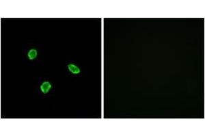 Immunofluorescence analysis of A549 cells, using SSTR1 Antibody. (SSTR1 抗体  (AA 9-58))