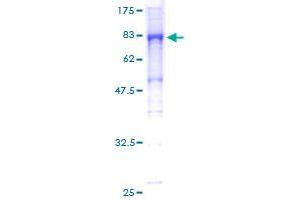 Image no. 1 for Kelch-Like 25 (KLHL25) (AA 1-589) protein (GST tag) (ABIN1308813) (KLHL25 Protein (AA 1-589) (GST tag))
