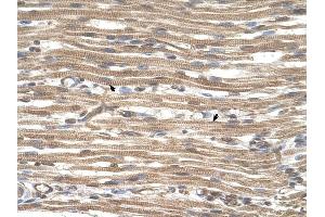 ACTR2 antibody was used for immunohistochemistry at a concentration of 4-8 ug/ml to stain Skeletal muscle cells (arrows] in Human Muscle. (ACTR2 抗体)