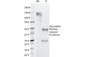 SDS-PAGE Analysis Purified Cytokeratin 1 Mouse Monoclonal Antibody (LHK1). (Cytokeratin 1 抗体  (C-Term))