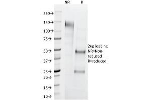 SDS-PAGE Analysis Purified Cytokeratin 1 Mouse Monoclonal Antibody (LHK1). (Cytokeratin 1 抗体  (C-Term))