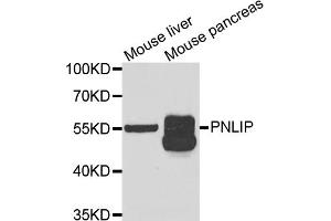 Western blot analysis of extracts of various cell lines, using PNLIP antibody. (PNLIP 抗体)