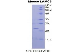 SDS-PAGE analysis of Mouse Laminin gamma 3 Protein. (LAMC3 蛋白)