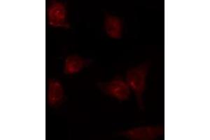 Immunofluorescence (fixed cells) (IF/ICC) image for anti-Prostaglandin I2 (Prostacyclin) Synthase (PTGIS) (Internal Region) antibody (ABIN6259069)