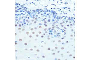 Immunohistochemistry (IHC) image for anti-Cyclin-Dependent Kinase 9 (CDK9) antibody (ABIN7266597)