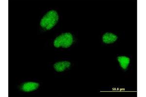 Immunofluorescence of monoclonal antibody to ZNF131 on HeLa cell. (ZNF131 抗体  (AA 139-238))