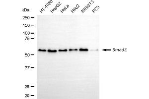 Western blotting analysis using Smad2 antibody (ABIN7800372).