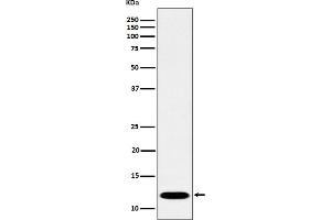 Western blot analysis of PCBD1 expression in Caco-2 cell lysate.
