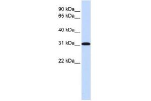 RPA4 antibody used at 1 ug/ml to detect target protein. (RPA4 抗体  (Middle Region))