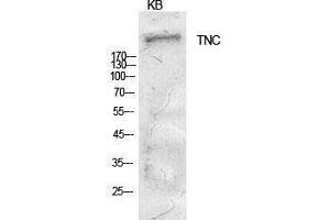 Western Blotting (WB) image for anti-Tenascin C (TNC) (Internal Region) antibody (ABIN3181403) (TNC 抗体  (Internal Region))