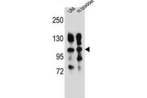Western Blotting (WB) image for anti-Integrin, alpha 5 (ITGA5) antibody (ABIN2996588) (ITGA5 抗体)