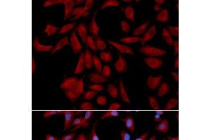 Immunofluorescence analysis of U2OS cells using UBE2I Polyclonal Antibody (UBE2I 抗体)
