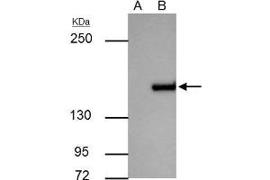 IP Image ROCK1 antibody immunoprecipitates ROCK1 protein in IP experiments. (ROCK1 抗体  (N-Term))
