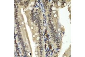 Immunohistochemistry of paraffin-embedded rat Intestine using RBBP5 antibody.