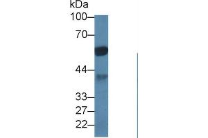 Western Blot; Sample: Porcine Cerebrum lysate; Primary Ab: 1µg/ml Rabbit Anti-Human PPP1Ca Antibody Second Ab: 0. (PPP1CA 抗体  (AA 2-330))