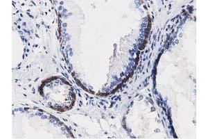 Immunohistochemical staining of paraffin-embedded Human Kidney tissue using anti-ALDH1L1 mouse monoclonal antibody. (ALDH1L1 抗体)