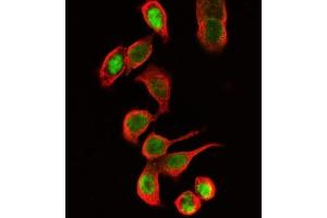 IF analysis of Tubulin beta using anti-Tubulin beta antibody (ABIN7602744) and anti-FOSB antibody (ABIN7599279).