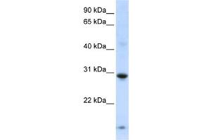 WB Suggested Anti-ZNF138 Antibody Titration:  0.