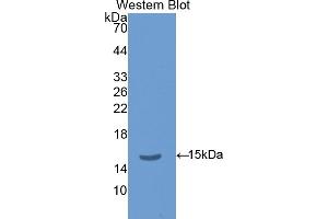 Western blot analysis of the recombinant protein. (TSHB 抗体  (AA 21-138))