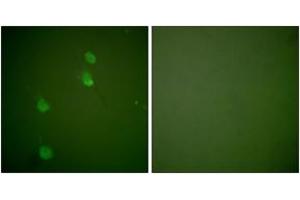 Immunofluorescence analysis of NIH-3T3 cells, using Cullin 2 Antibody. (Cullin 2 抗体  (AA 696-745))