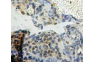 Used in DAB staining on fromalin fixed paraffin-embedded Ovary tissue (BCL9 抗体  (AA 1119-1328))