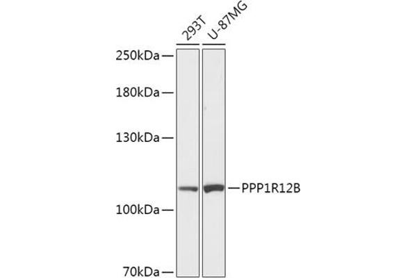 PPP1R12B 抗体  (AA 660-930)