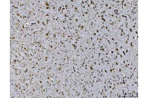 IHC analysis of Ataxin 1 using anti-Ataxin 1 antibody (ABIN7602773).