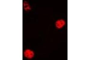 Immunofluorescent analysis of Cyclin C staining in Hela cells. (Cyclin C 抗体)
